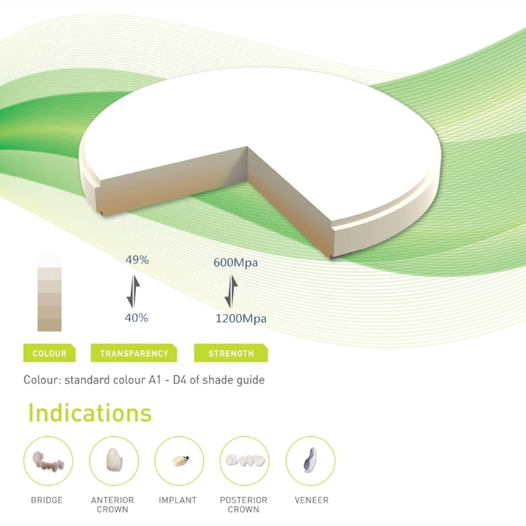 High strength multilayer zirconia dental feature