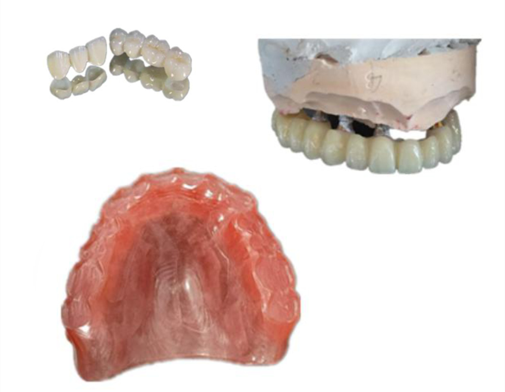 PMMA IN DENTISTRY APPLICATION