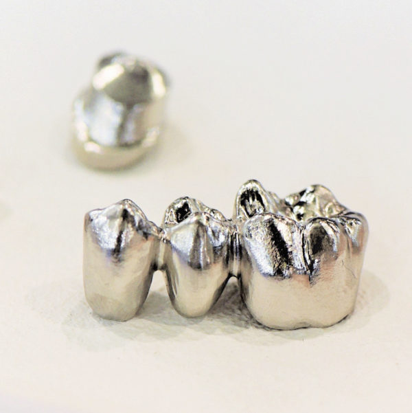 cobalt crhome prosthesis in dentistry application