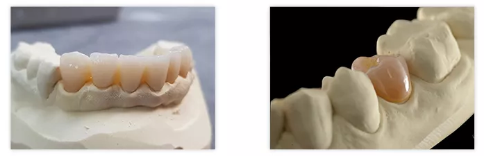 CAD-CAM Multilayer Zirconia Case
